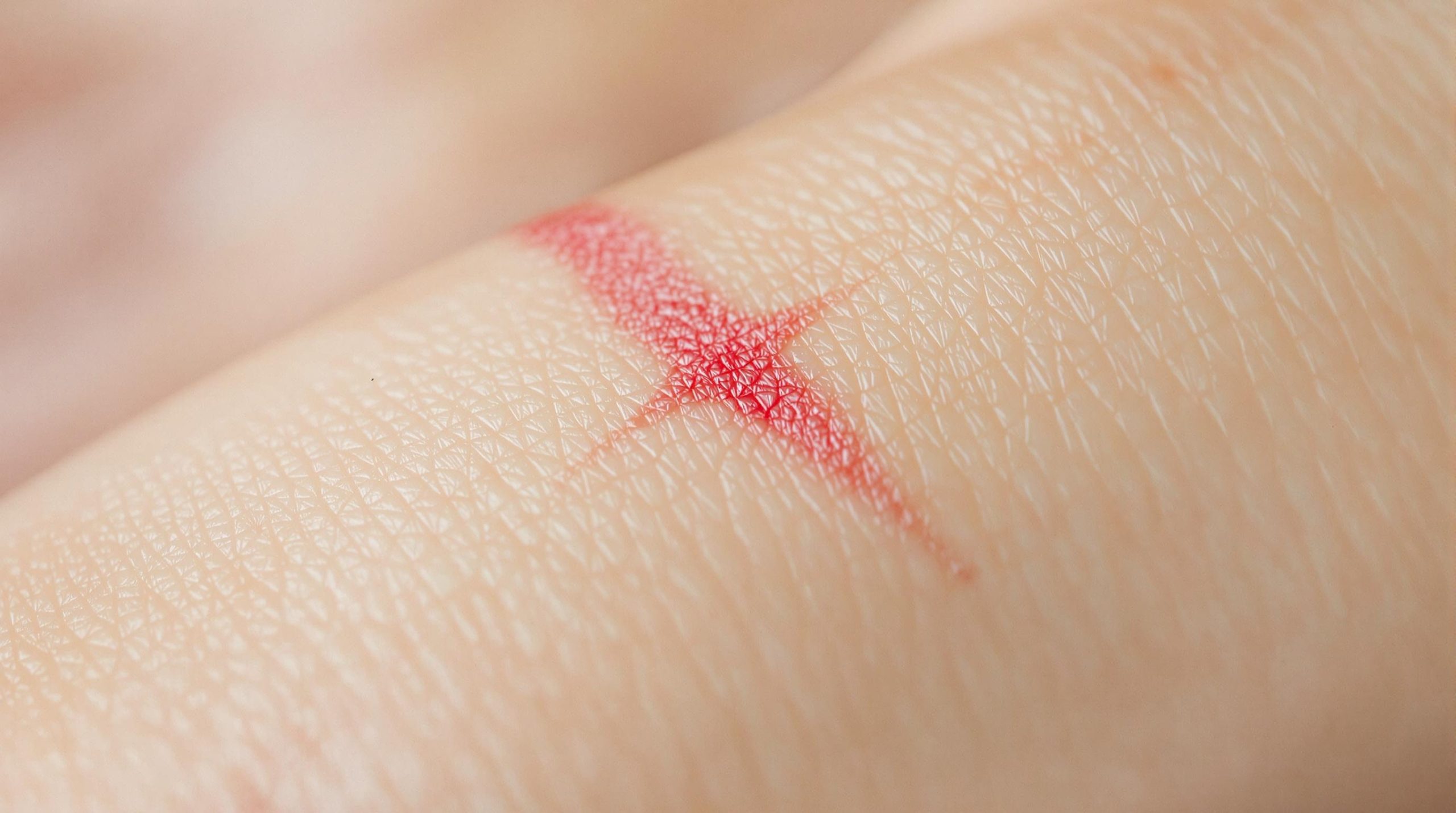 Combien de temps une cicatrice reste-t-elle rouge ? - Vie Harmonieuse